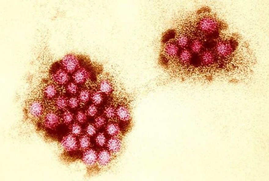 norovirus-em-mutacao3A-desafios-e-surto-de-virose-no-litoral-de-sao-paulo