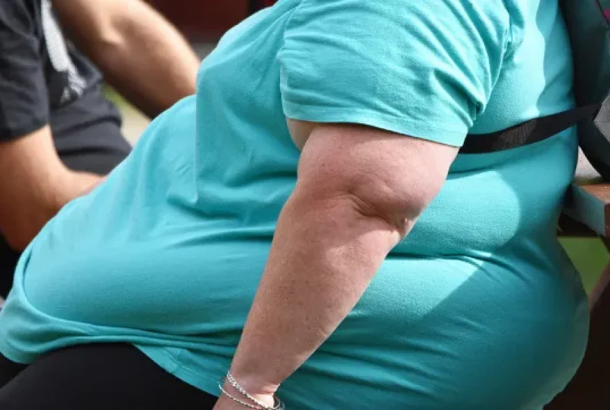 Mais da metade da população mundial estará acima do peso ou obesa até 2035