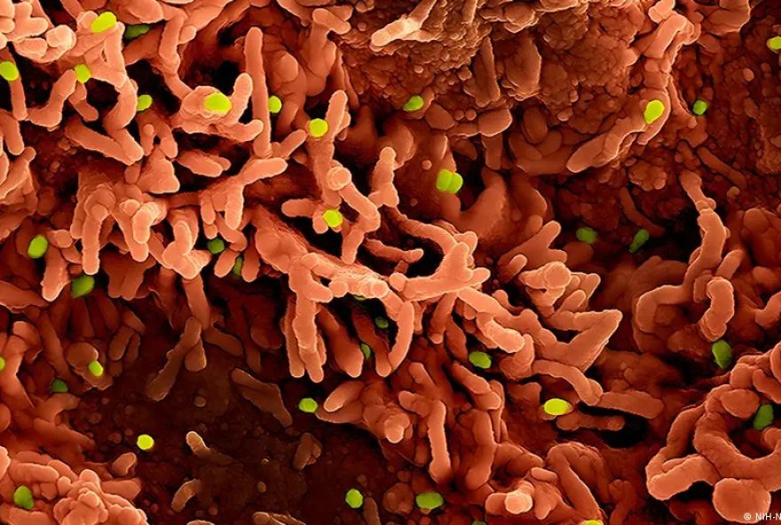 os-tres-principais-virus-que-preocupam-especialistas-em-2026 os-tres-principais-virus-que-preocupam-especialistas-em-2026