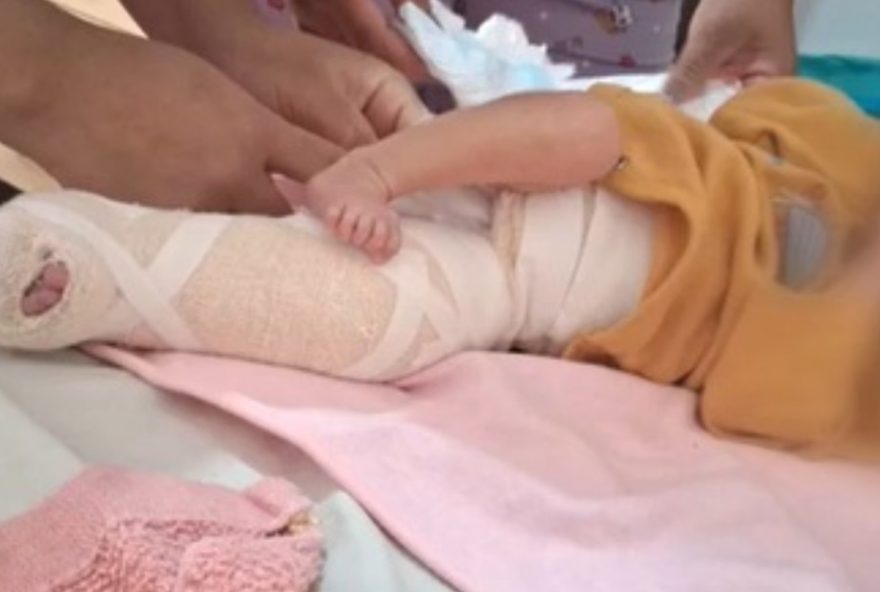pai-identifica-fratura-em-perna-de-bebe-apos-teste-do-pezinho-em-aparecida-de-goiania2C-diz-policia