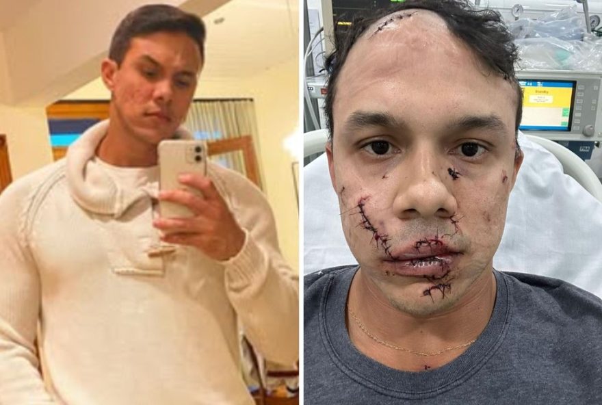 personal-trainer-agredido-com-45-pontos-no-rosto-relata-agressao-em-sp3A-tenho-que-pagar-aluguel