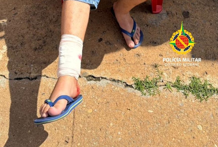 pitbull-ataca-homem-e-mata-cachorro-no-paranoa2C-df3A-pmdf-age-para-conter-o-animal