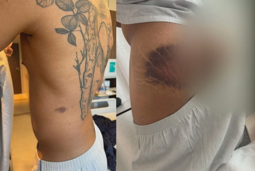 pms-denunciados-por-tortura-de-colega3A-mp-pede-perda-do-cargo-e-indenizacao