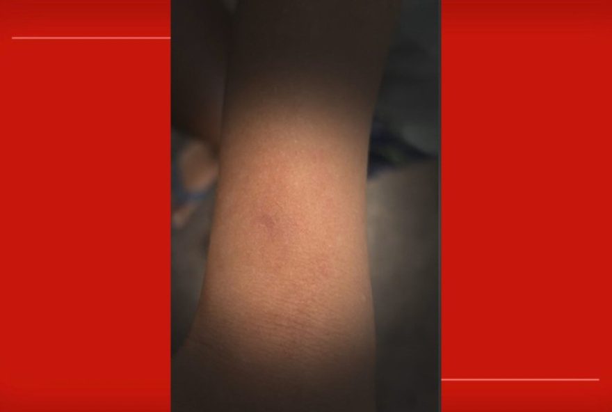 professora-e-mordida-por-crianca-de-5-anos-em-escola-do-df3A-veja-detalhes-e-outras-noticias-locais-no-de_df
