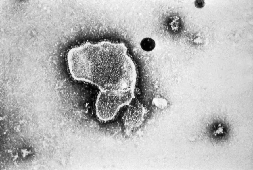 quais-sao-os-riscos-de-contaminacao-por-metapneumovirus-em-santa-catarina3F