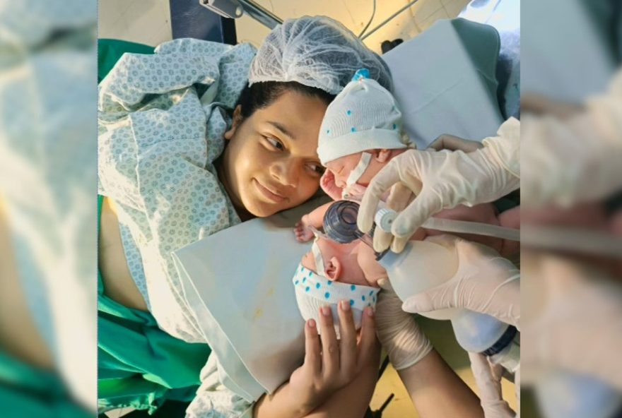 segundo-gemeo-siames-de-mt-morre-apos-cirurgia-de-separacao segundo-gemeo-siames-de-mt-morre-apos-cirurgia-de-separacao