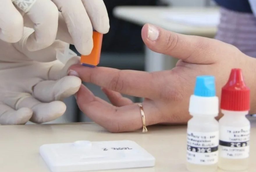 sesab-desmente-surto-de-hiv-entre-jovens-na-bahia-em-20253A-apenas-93-casos