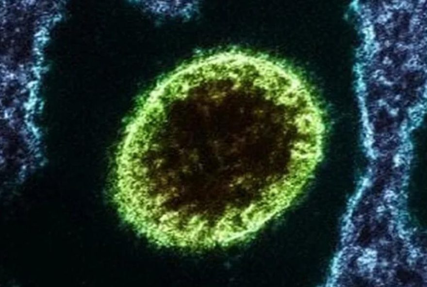 surto-de-nipah-na-india3A-oms-alerta-para-virus-mortal-transmitido-por-morcegos surto-de-nipah-na-india3A-oms-alerta-para-virus-mortal-transmitido-por-morcegos