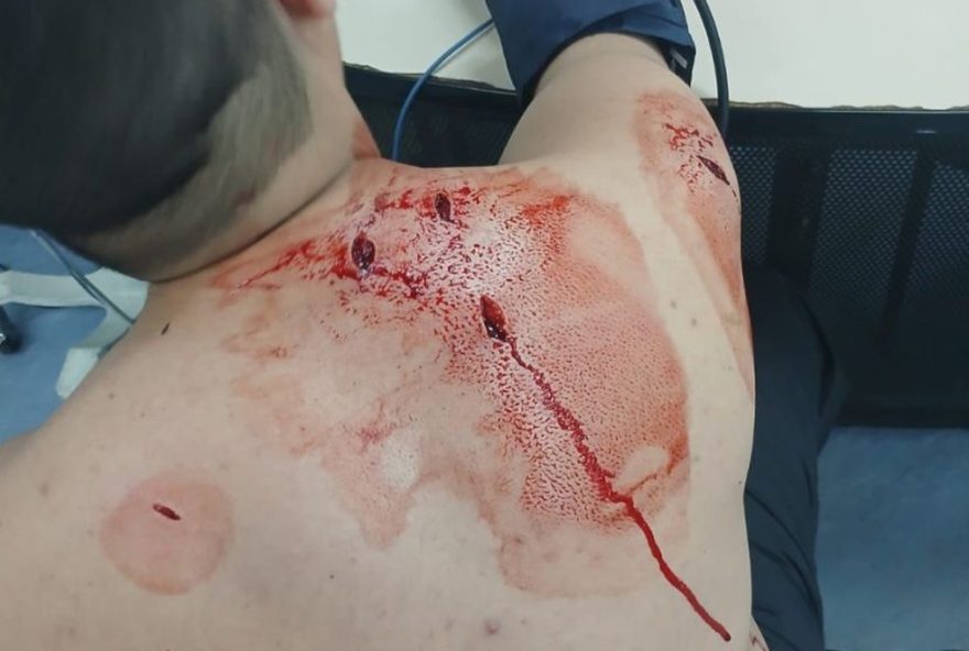 suspeito-tenta-roubar-moto-com-faca-em-santa-cruz3B-policia-prende-autor-escondido.-colabore-para-um-bairro-mais-seguro