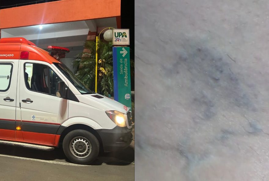 tecnica-de-enfermagem-do-samu-e-agredida-com-barra-de-ferro-em-casa-noturna-de-francisco-beltrao3A-profissional-relata-medo-e-abalo-emocional