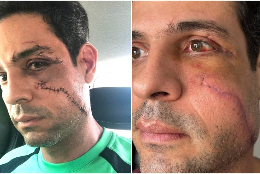 tecnico-em-informatica-que-agrediu-empresario-com-copo-de-vidro-tem-processo-suspenso-em-fortaleza tecnico-em-informatica-que-agrediu-empresario-com-copo-de-vidro-tem-processo-suspenso-em-fortaleza