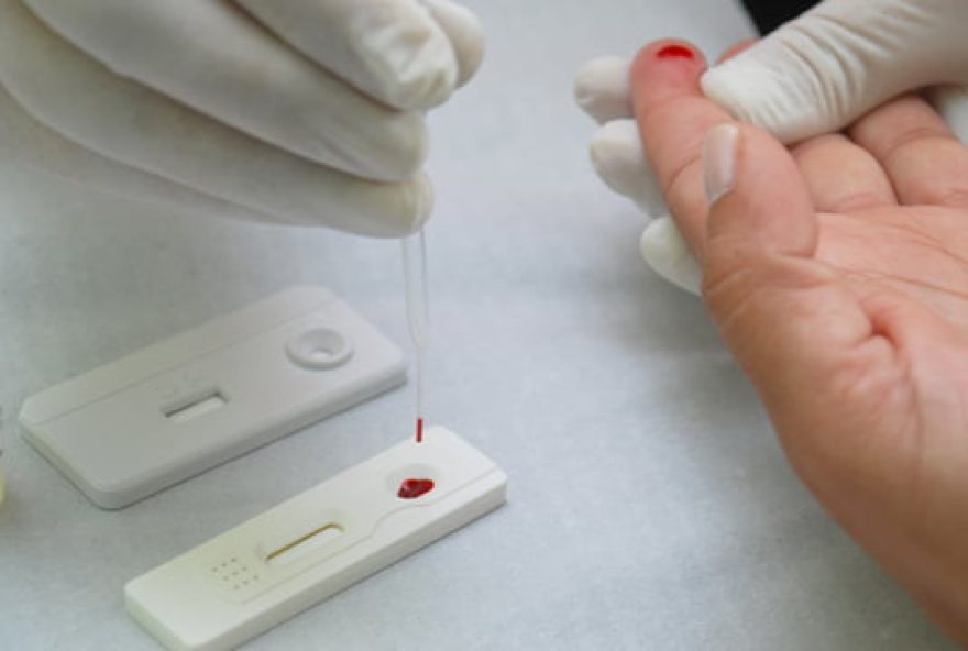 Teste rápido de sífilis, a principal forma de diagnóstico da doença, está disponível gratuitamente nos serviços de saúde do SUS. (Foto: Agência Aids)