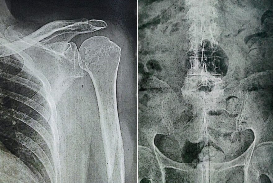 tj-sp-condena-assai-atacadista-a-indenizar-idosa-de-81-anos-por-queda-em-mercado
