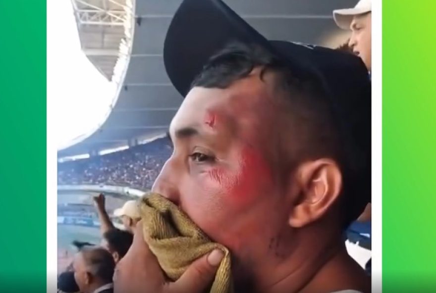 torcedor-atropelado-nao-desiste-e-acompanha-remo-no-estadio-por-amor-ao-filho