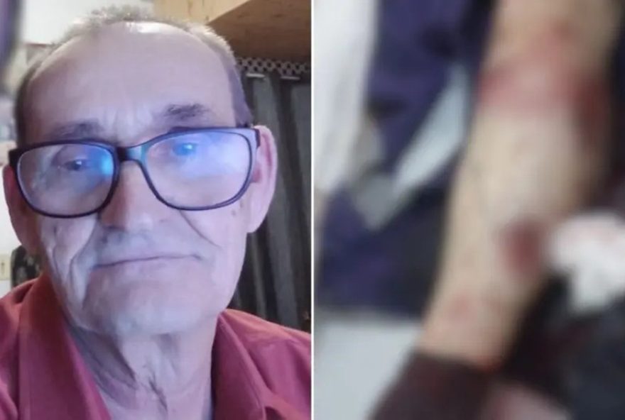 trabalhador-de-70-anos-e-atacado-por-pit-bull-durante-leitura-de-medidor-de-energia-em-sc3A-o-que-diz-a-celesc trabalhador-de-70-anos-e-atacado-por-pit-bull-durante-leitura-de-medidor-de-energia-em-sc3A-o-que-diz-a-celesc