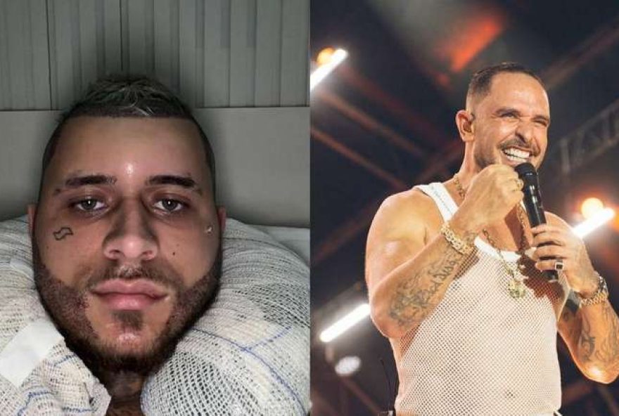 transplante-capilar3A-celebridades-quebram-tabu-e-mostram-resultados-naturais transplante-capilar3A-celebridades-quebram-tabu-e-mostram-resultados-naturais