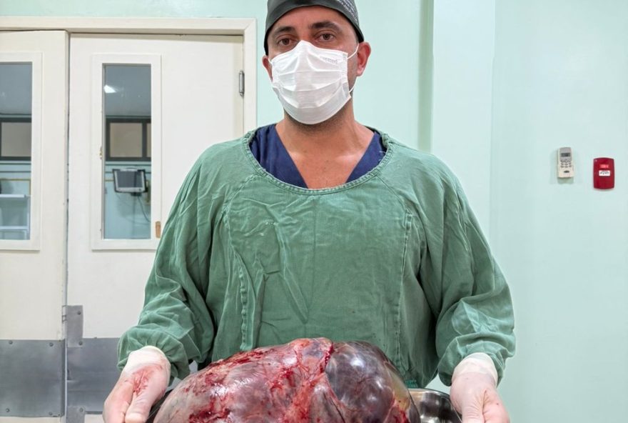 tumor-de-ovario-de-15kg-e-retirado-em-cirurgia-de-alta-complexidade-em-rio-das-ostras