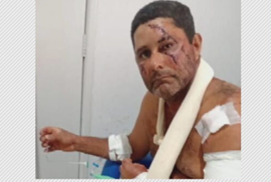 vaqueiro-e-atacado-por-onca-pintada-em-goias-se-defende-com-facao-e-sobrevive