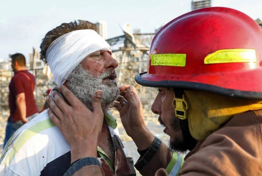 x89046565_A-wounded-man-is-checked-by-a-fireman-near-the-scene-of-an-explosion-in-Beirut-on-August-4.jpg,qposicaoFoto3.pagespeed.ic.Ub8hoA_10D