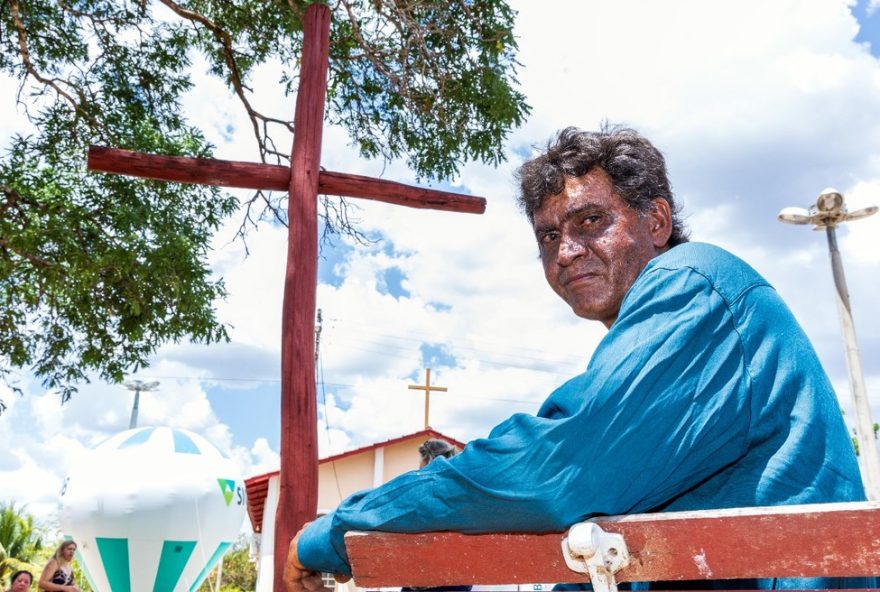 xeroderma-pigmentoso-em-araras2C-goias3A-a-rotina2C-desafios-e-conquistas-da-comunidade-com-doenca-rara-entenda-agora xeroderma-pigmentoso-em-araras2C-goias3A-a-rotina2C-desafios-e-conquistas-da-comunidade-com-doenca-rara-entenda-agora