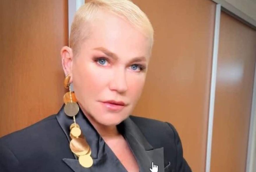 xuxa-meneghel-recebe-alta-apos-microcirurgia-de-hernia-de-disco-em-hospital-de-sao-paulo-nesta-quarta-feira