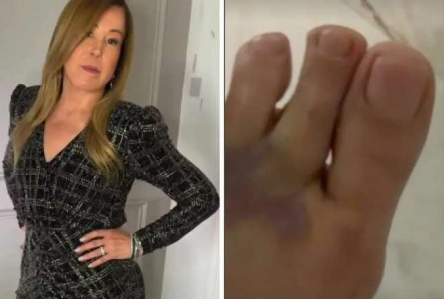 zilu-camargo-atualiza-fas-sobre-recuperacao-apos-acidente-domestico zilu-camargo-atualiza-fas-sobre-recuperacao-apos-acidente-domestico